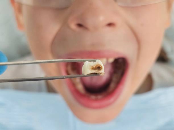 Best Pediatric Emergency Dentist in Marriott Slaterville, UT