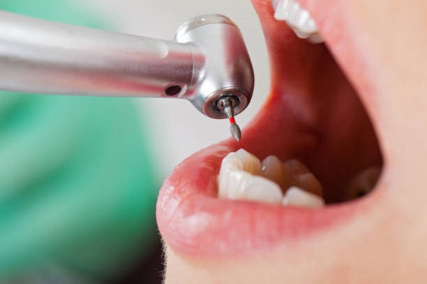 Best Emergency Treatment for Dental Infections or Abscesses in Marriott Slaterville, UT